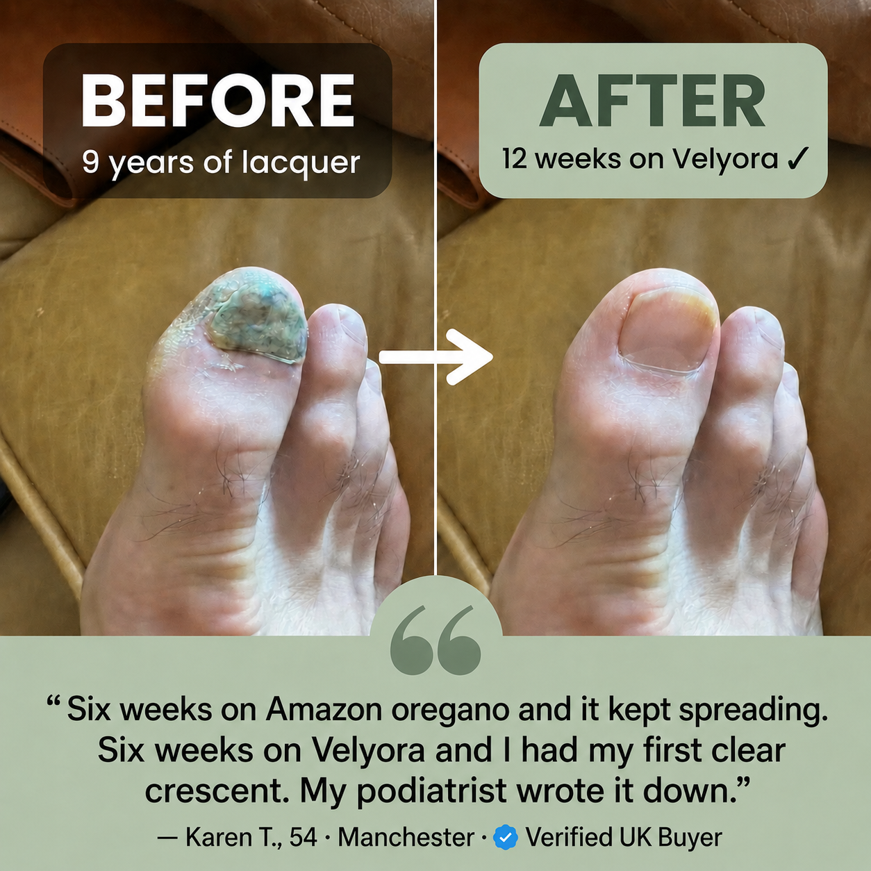 Velyora™ Oregano & Black Seed Oil — Stop The Spreading Before It Reaches The Point Your Lacquer Already Passed