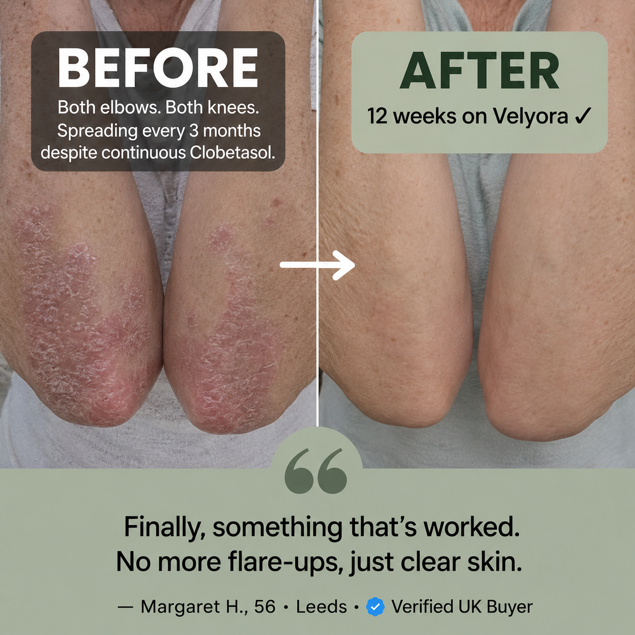 Velyora™ Oregano & Black Seed Oil — The Protocol That Finally Reaches The Immune Switch